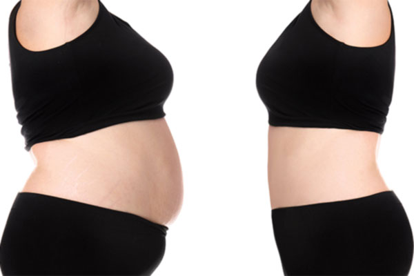 Weight loss before and after.