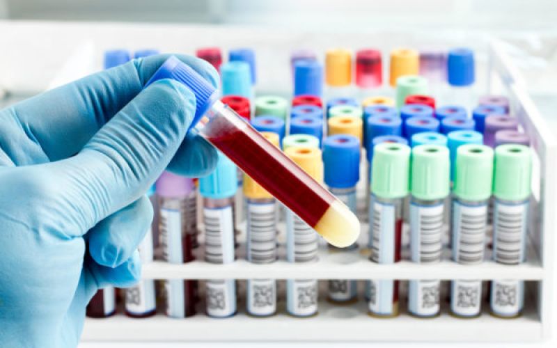 Clinic worker holding lab test tubes.